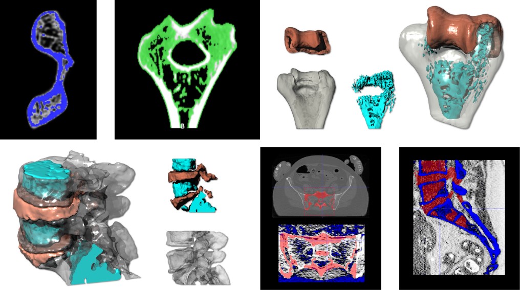 Revenant: 3D Printed, Mass Customizable Biomedical Phantoms